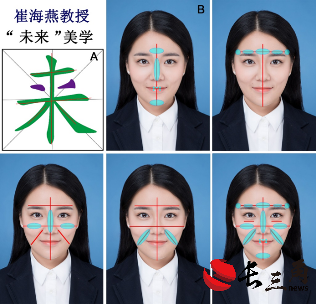 图1